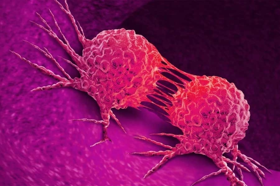 OPASNOST PRIJETI: Stručnjaci upozoravaju, ove osobe mogle bi imati veći rizik obolijevanja od raka…