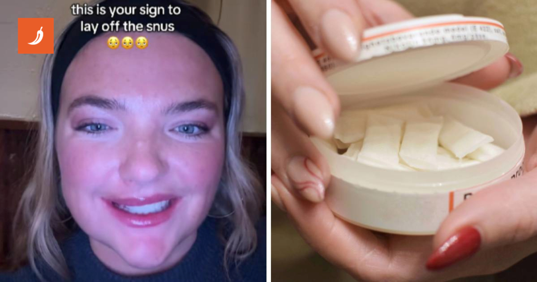 Pokazala je posljedice uzimanja snusa. Taj nikotinski proizvod mladi sve više koriste