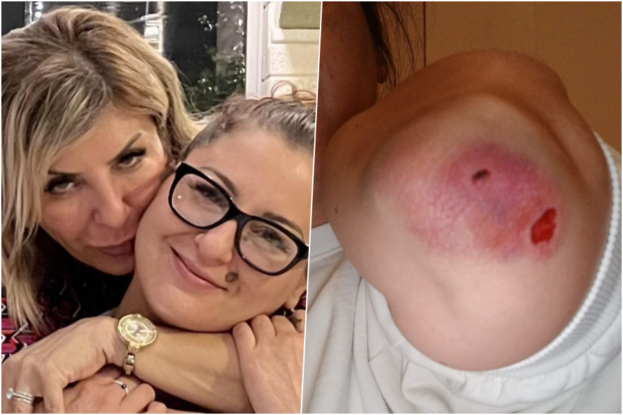 PROCURILI NOVI DETALJI: Član Pantera pretukao kćerku Đemile Talić-Gabriel