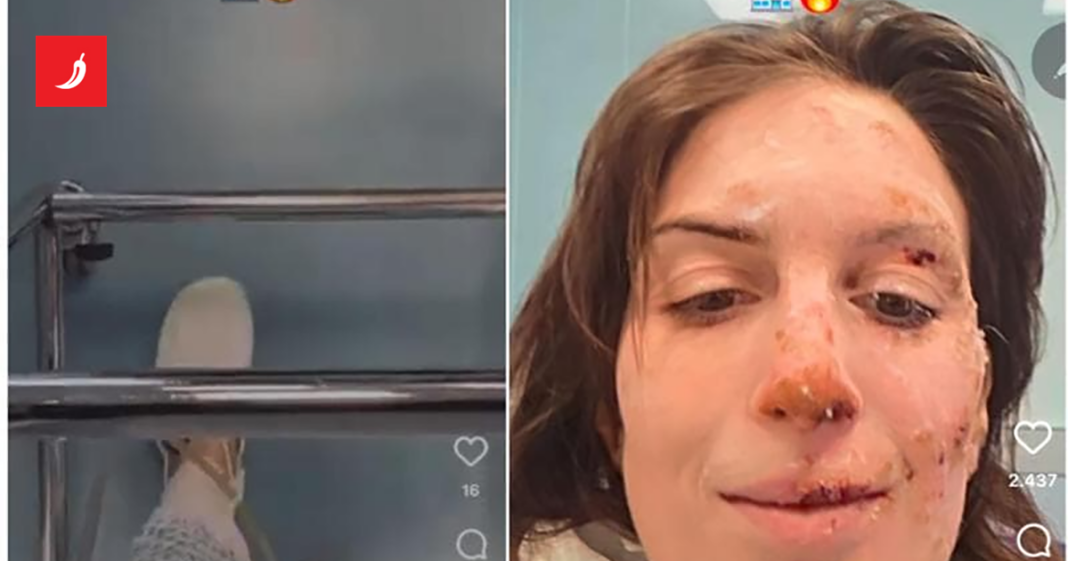 Talijanka preživjela požar u Švicarskoj objavila story: “Ne znam kako sam se spasila”