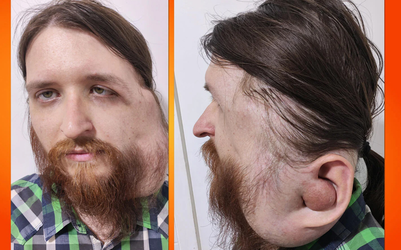 Pokrenut apel za pomoć Jasenku Ramiću (29): Pozovite 17040 kako bi skupili novac za liječenje