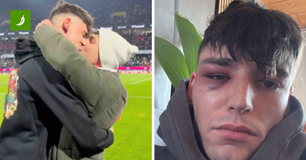 Ponovno napadnut sudac koji je zaprosio dečka pred 50.000 gledatelja u Bundesligi