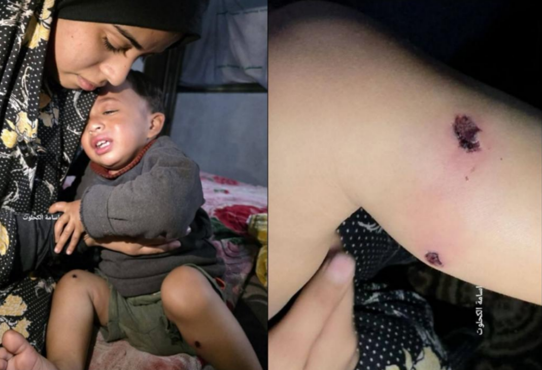 IZRAELSKI VOJNICI U GAZI MUČILI 18-MJESEČNU BEBU: Gasili cigarete i zabijali eksere u noge IZRAELSKI VOJNICI U GAZI MUČILI 18-MJESEČNU BEBU: Gasili cigarete i zabijali eksere u noge