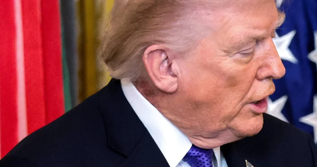 Šta je to na Trumpovom vratu? Crvena mrlja pokrenula nova nagađanja o njegovom zdravlju