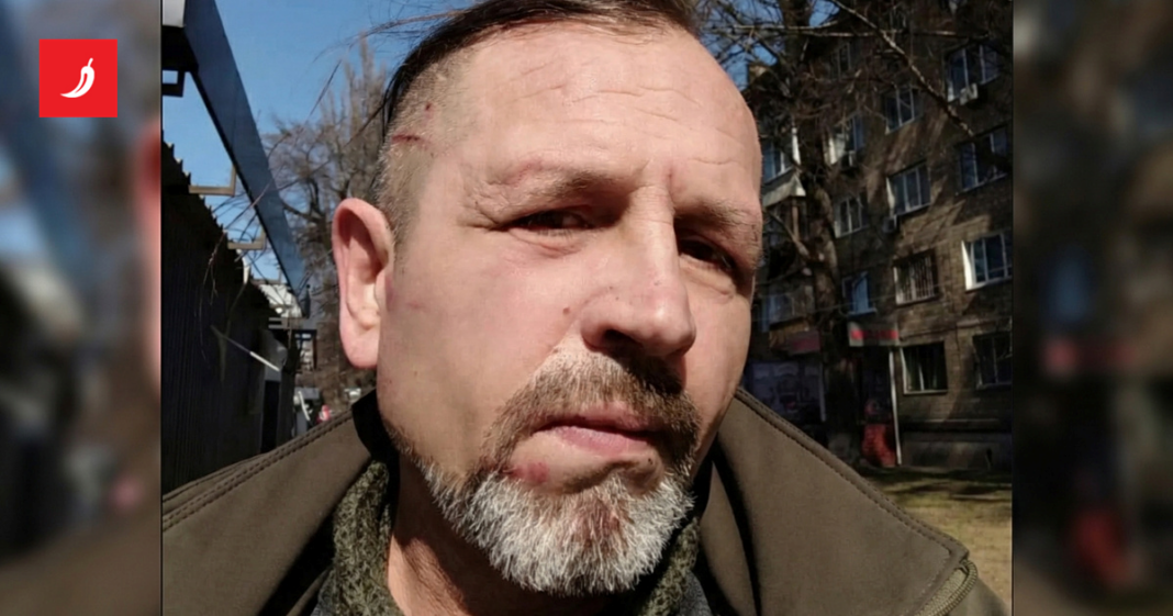 Ukrajinski aktivist: Ugurali su me u kombi, odvezli u regrutacijski centar i prebili Ukrajinski aktivist: Ugurali su me u kombi, odvezli u regrutacijski centar i prebili