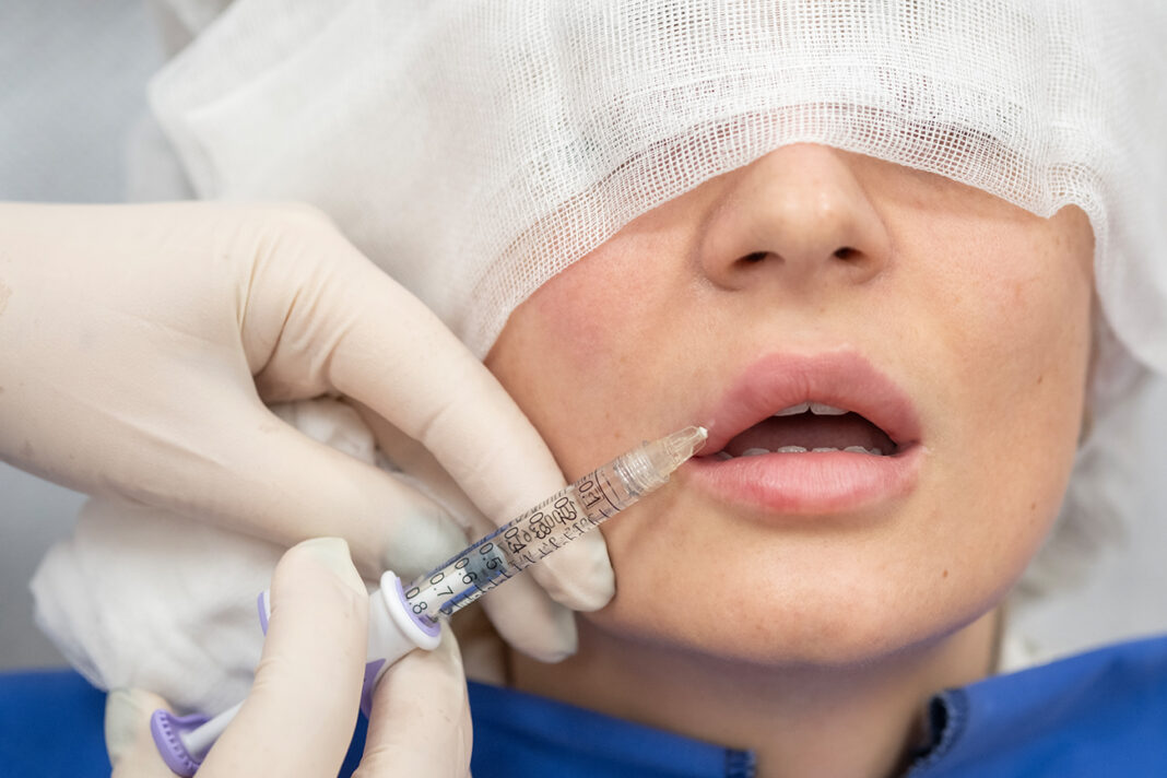 Nova pravila za estetske zahvate u FBiH Nova pravila za estetske zahvate u FBiH