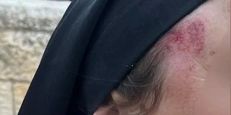 U okupiranom istočnom Jerusalemu napadnuta časna sestra: Sve češće nasilje jevrejskih ekstremista U okupiranom istočnom Jerusalemu napadnuta časna sestra: Sve češće nasilje jevrejskih ekstremista