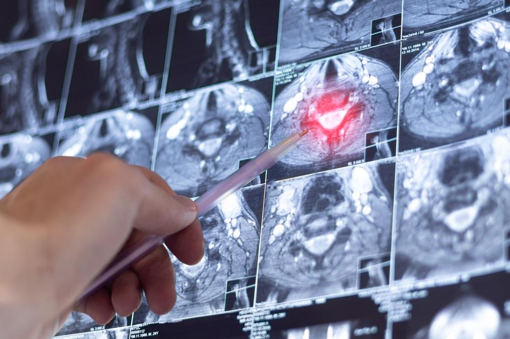 AI precizniji od lekara u hitnim slučajevima? Studija sa Harvarda pokrenula pitanja AI precizniji od lekara u hitnim slučajevima? Studija sa Harvarda pokrenula pitanja